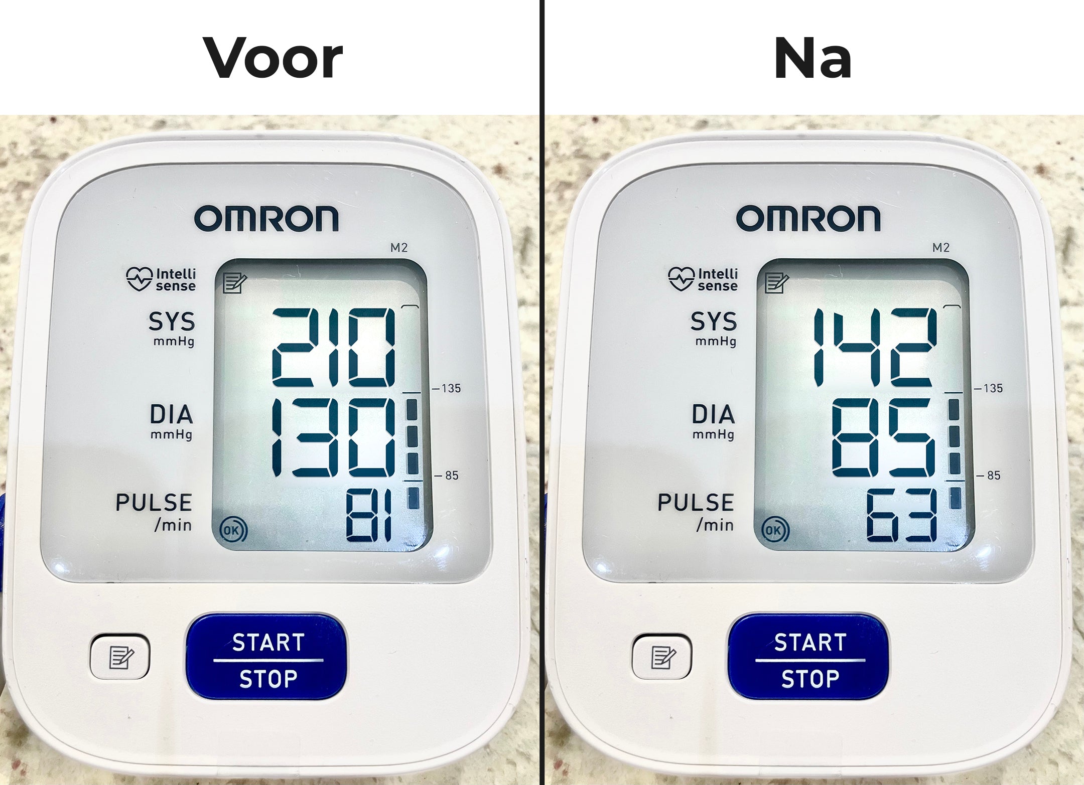 De Stille Doder in Je Slagaders: Hoe Ik Mijn Dodelijk Hoge Bloeddruk Verlaagde Zonder Gevaarlijke Medicatie